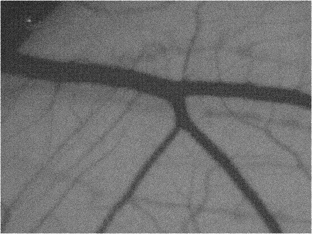 Blood vessel diameter measuring method based on digital image processing technology