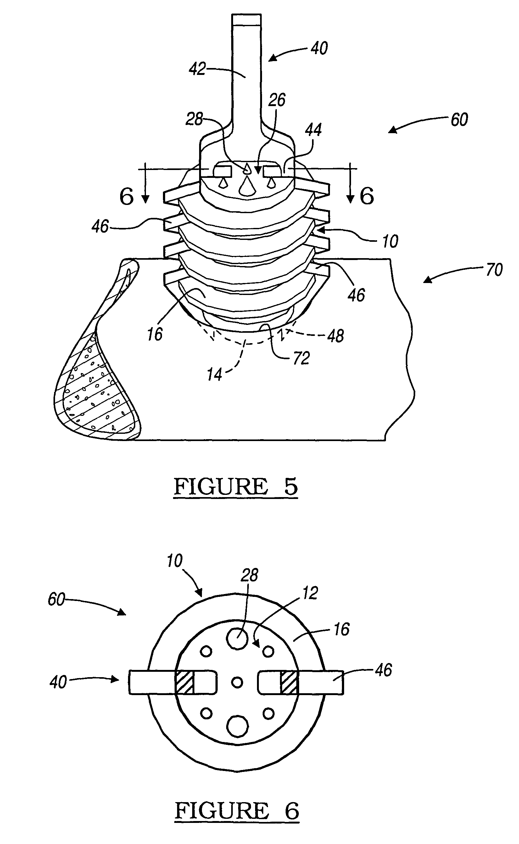 Method and apparatus for use of a self-tapping resorbable screw