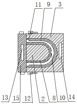 Removable shaping mould