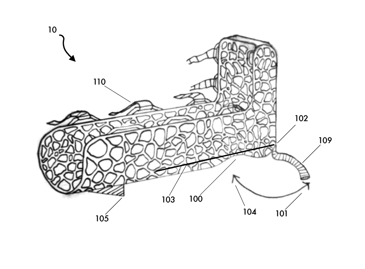 Orthopaedic brace and method for manufacturing an orthopaedic brace