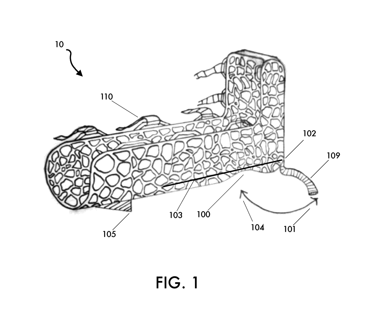 Orthopaedic brace and method for manufacturing an orthopaedic brace