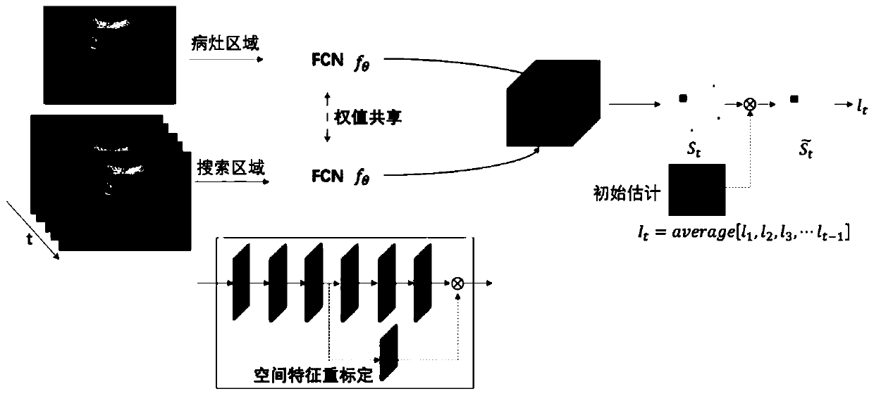 Liver tumor angiogenesis quantitative analysis method based on dynamic ultrasound contrast