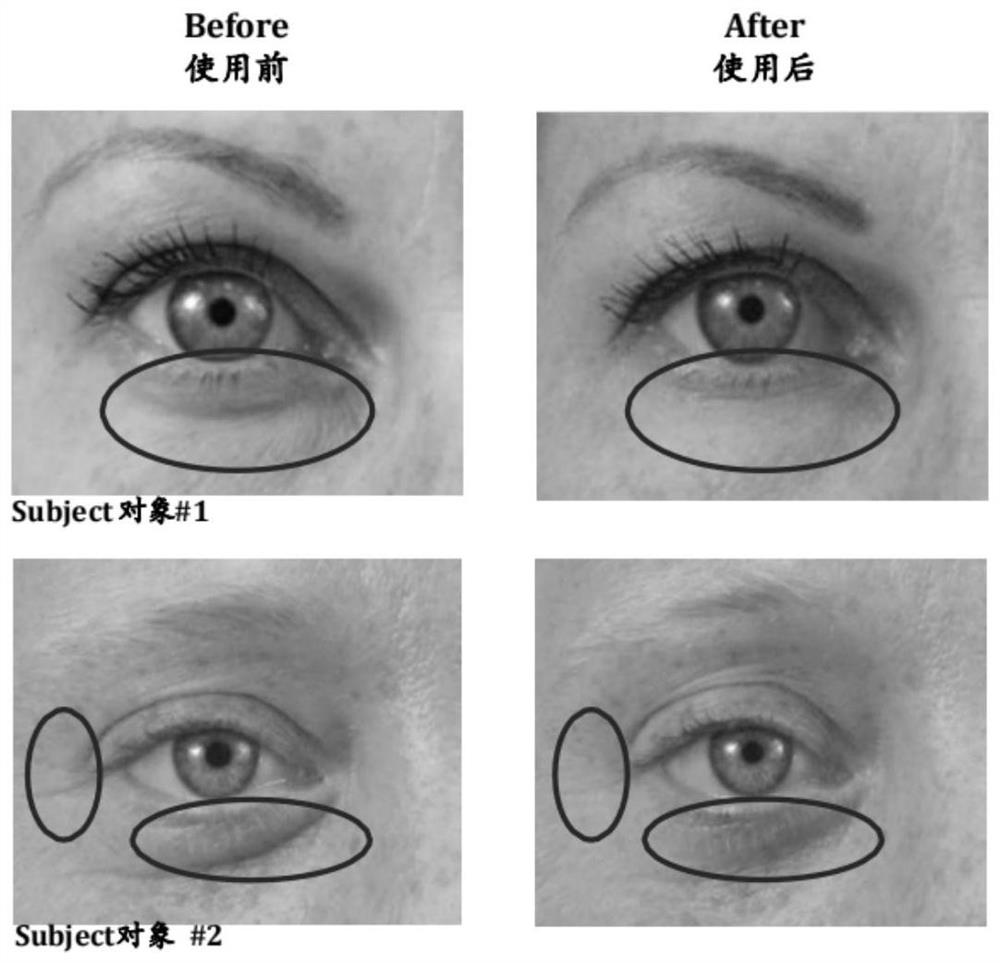 Eye essence for fading dark circle and eyeprint and preparation method thereof