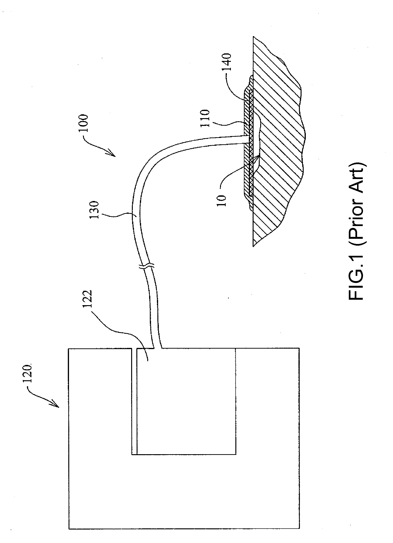 Wound drainage equipment, conduit, connector and wound cover