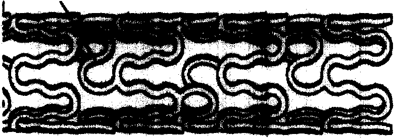 Centrosymmetric conjugation type equidistant constrictor for cylindrical net support