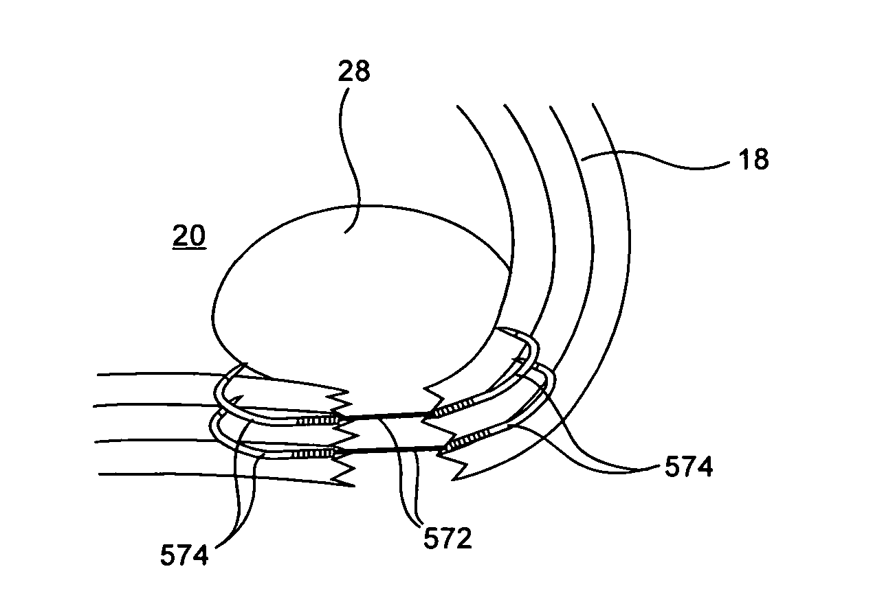 Devices, systems and methods for augmenting intervertebral discs