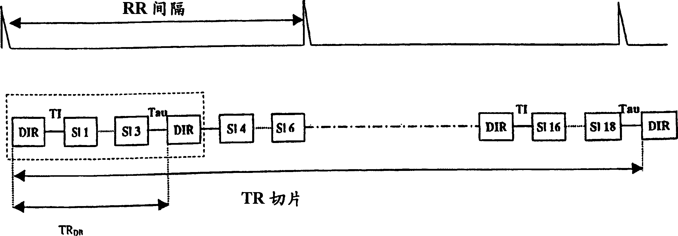 Rapid multislice black blood double-inversion recovery technique for blood vessel imaging