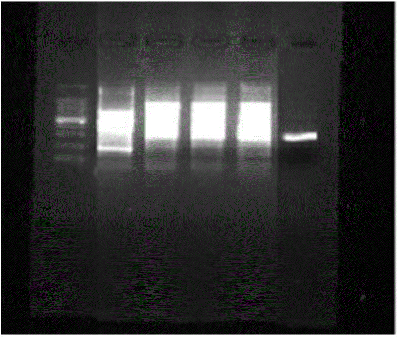 Method and kit for detecting polymorphism of XRCC1 gene