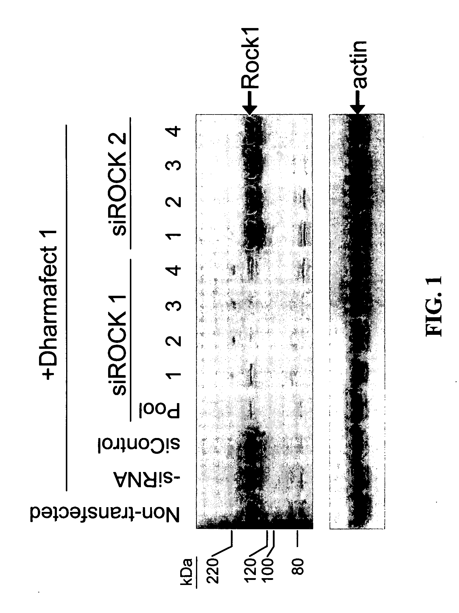 RNAi-mediated inhibition of RHO kinase for treatment of ocular disorders