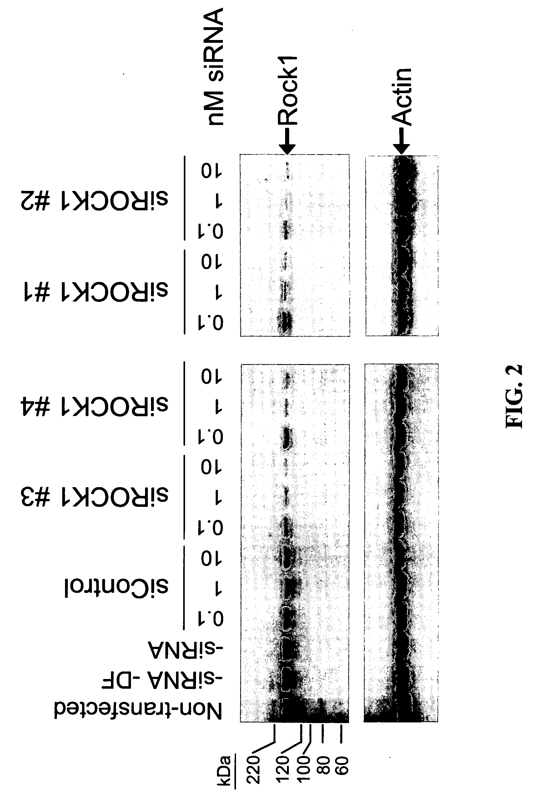 RNAi-mediated inhibition of RHO kinase for treatment of ocular disorders