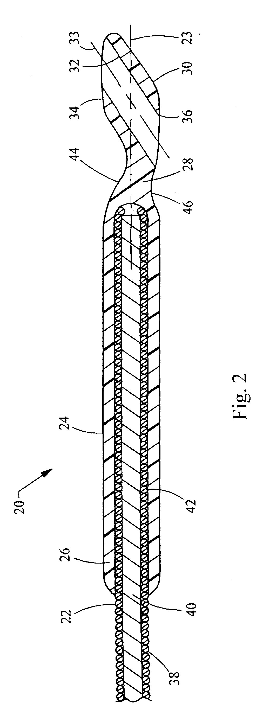 Wire guide having distal coupling tip