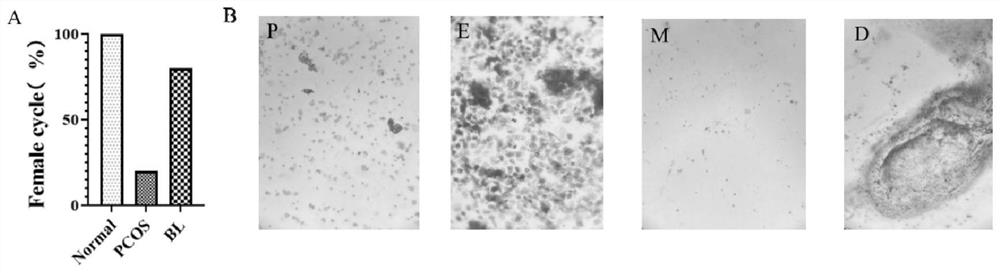 Application of radix ampelopsis extract in preparation of medicine for preventing and/or treating polycystic ovarian syndrome