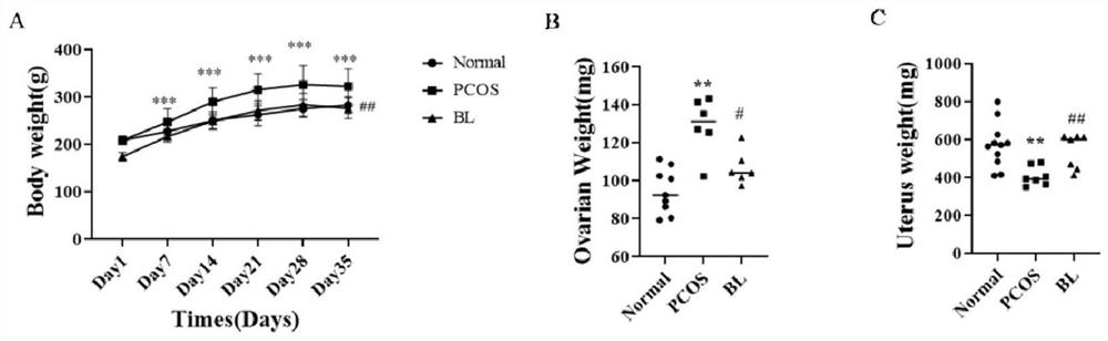 Application of radix ampelopsis extract in preparation of medicine for preventing and/or treating polycystic ovarian syndrome