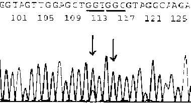 Method for rapidly concentrating and extracting nucleic acid target cells from sample