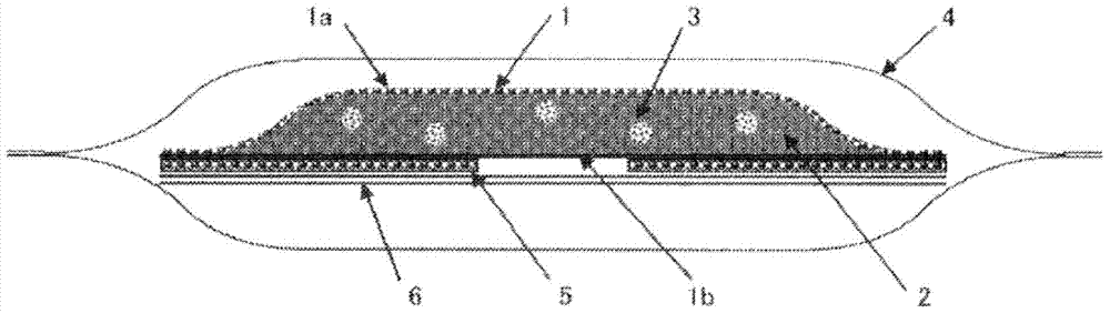 Nasal ventilation improvement device