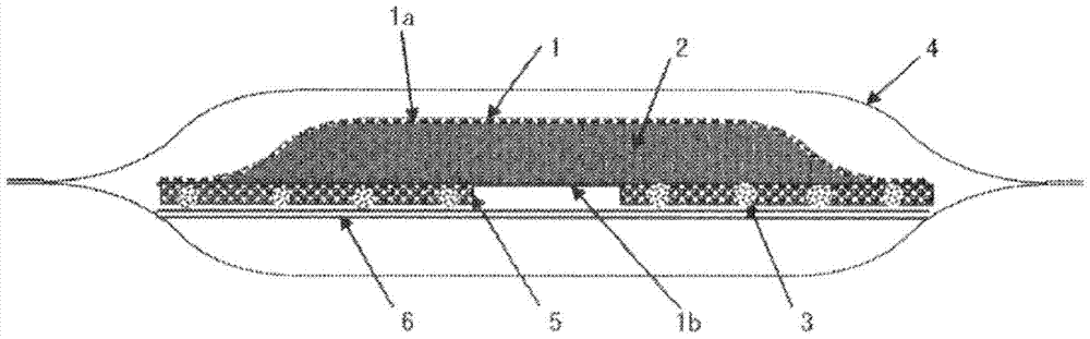 Nasal ventilation improvement device