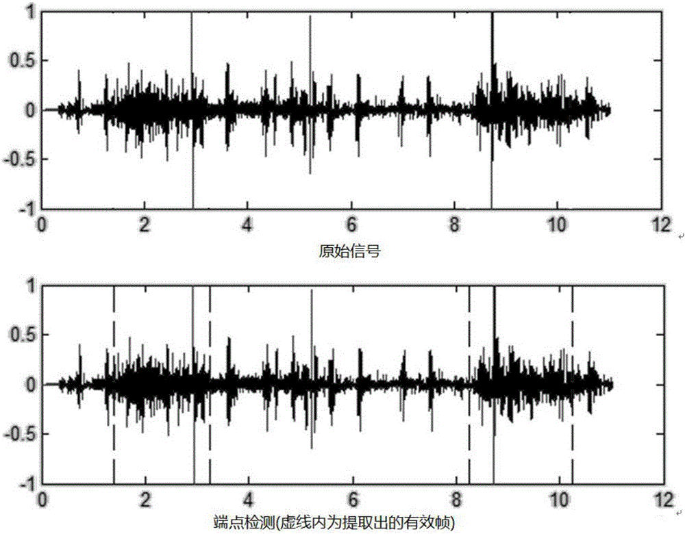 Digital stethoscope and method for filtering heart sounds and extracting lung sounds