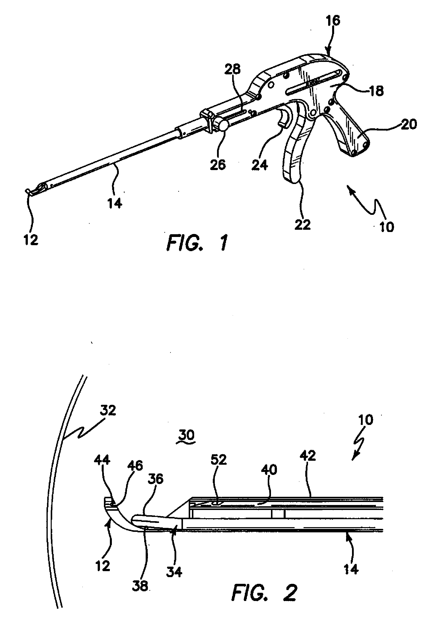 Arthroscopic soft tissue plication systems and methods