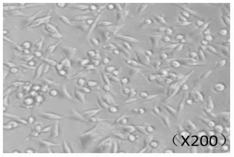 Triple-negative breast cancer cisplatin drug-resistance cell line, preparation method and uses thereof