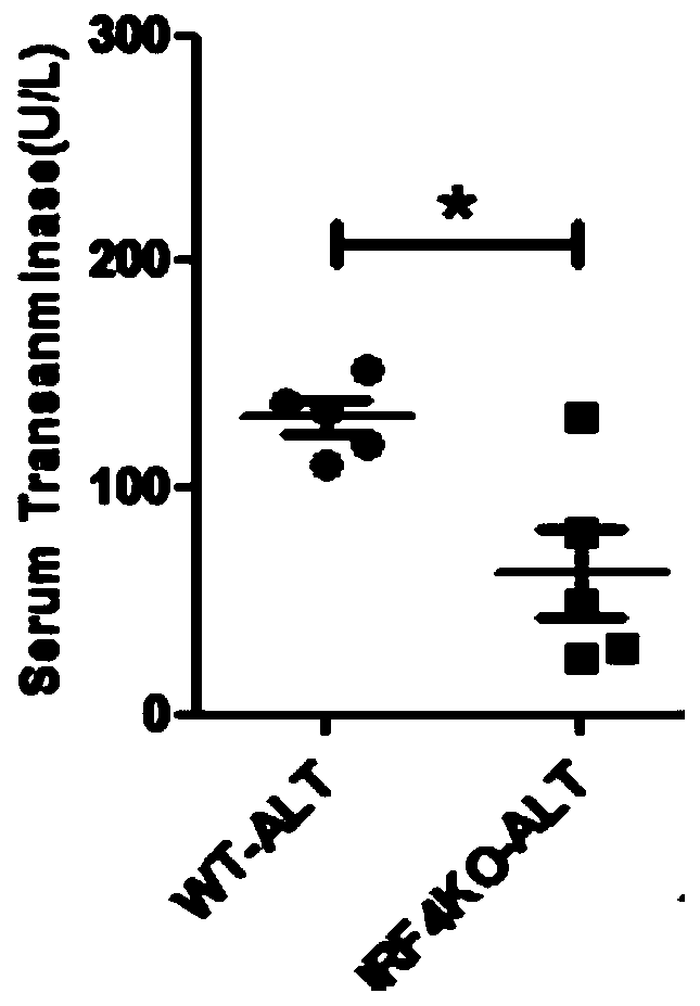 Application of IRF4 gene in resisting schistosoma infection