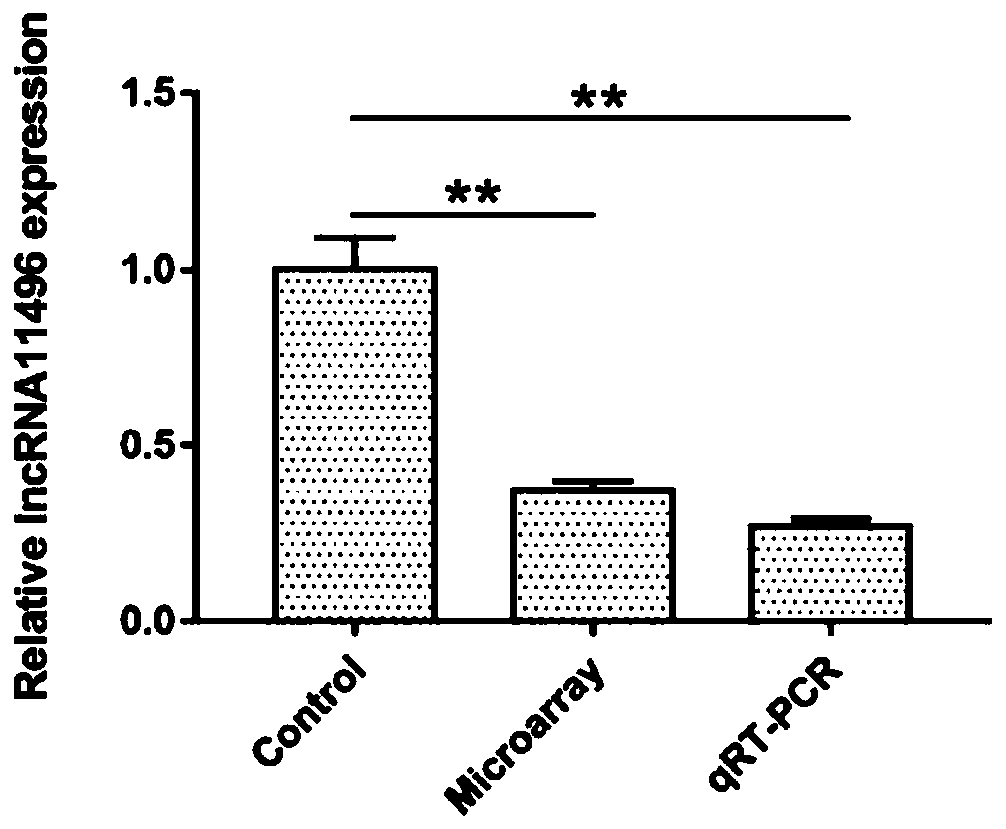 Application of lncRNA 11496 in diagnosis and treatment of toxoplasmosis