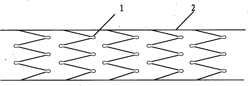 Blood vessel bracket prosthesis