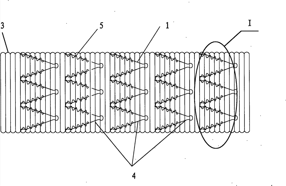 Blood vessel bracket prosthesis