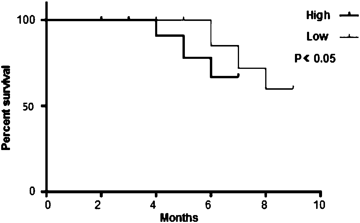 Application of miRNA-4741 as diagnostic marker for primary liver cancer, and method for detecting miRNA-4741