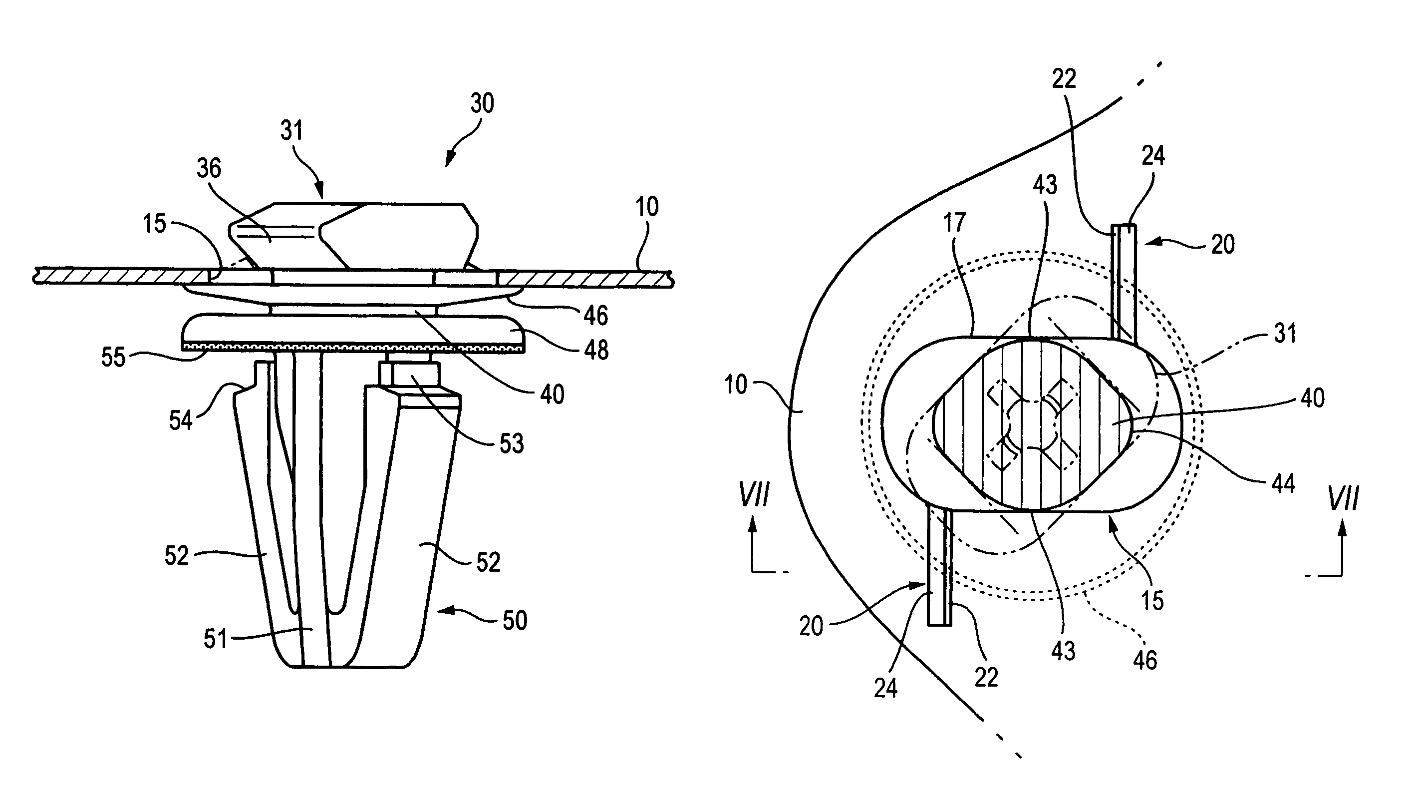 Parts attaching structure