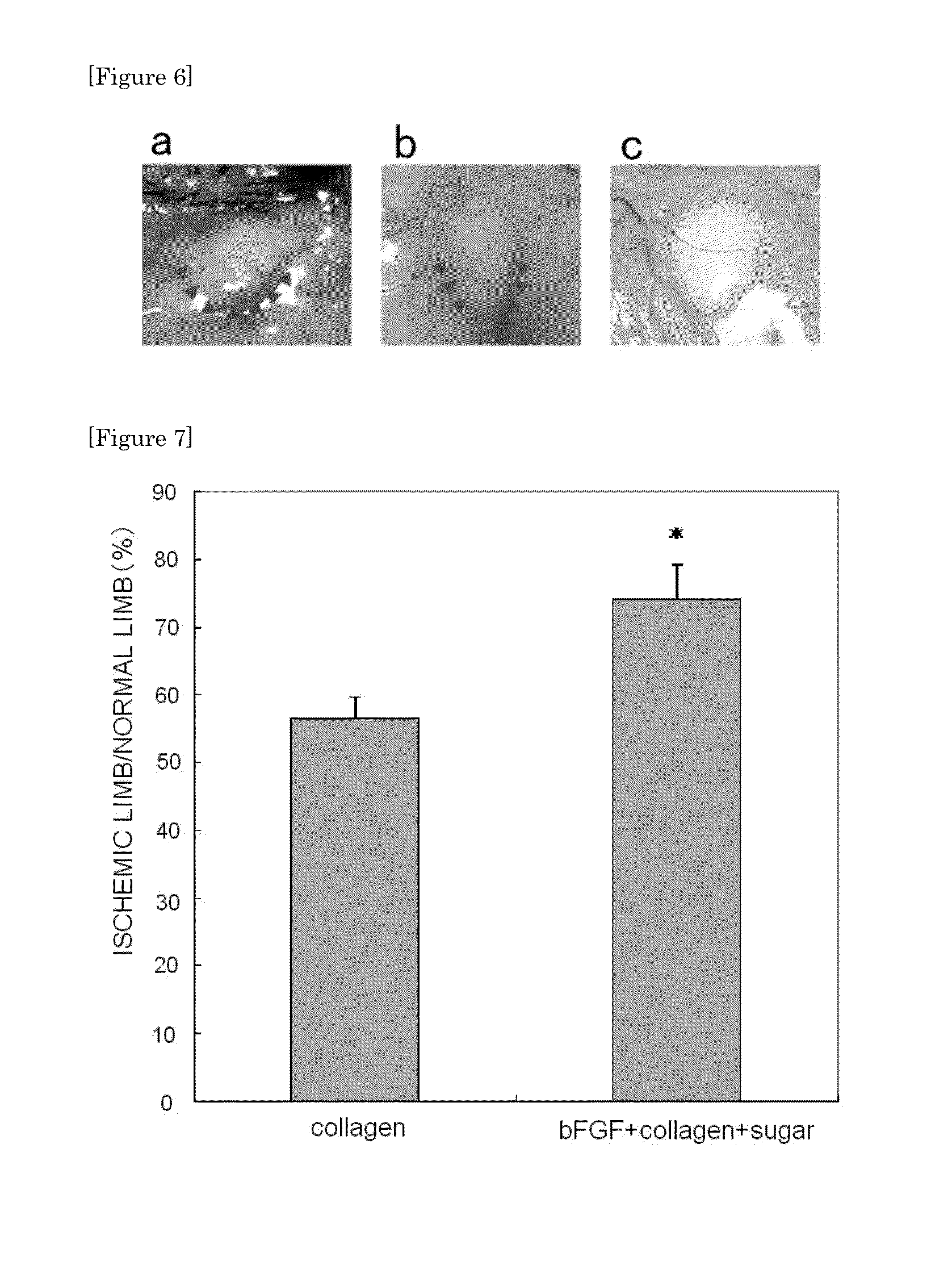 Sustained-Release Pharmaceutical Composition