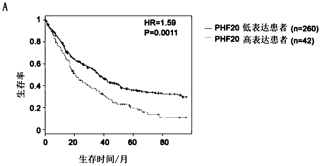 Breast cancer tumor related tumor marker, application and kit