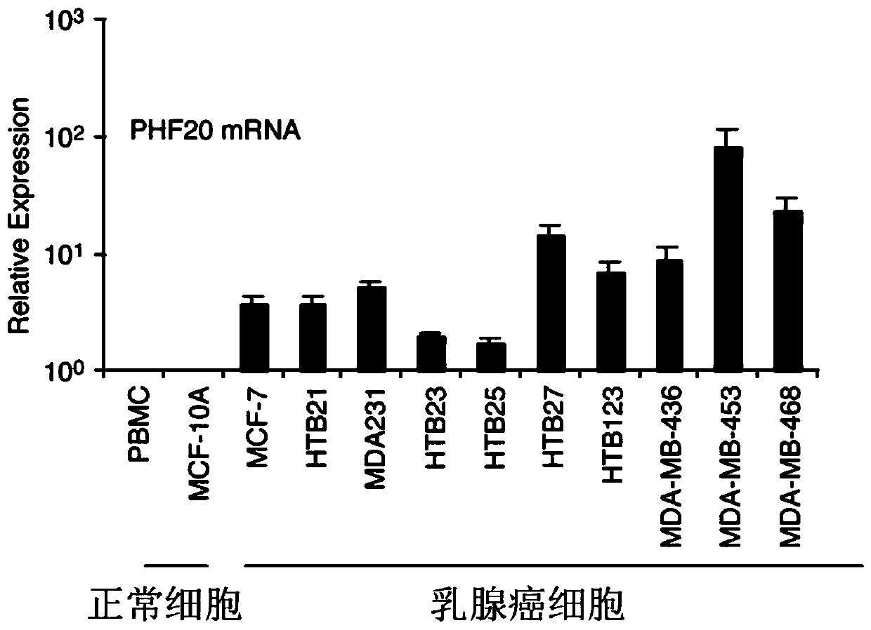 Breast cancer tumor related tumor marker, application and kit