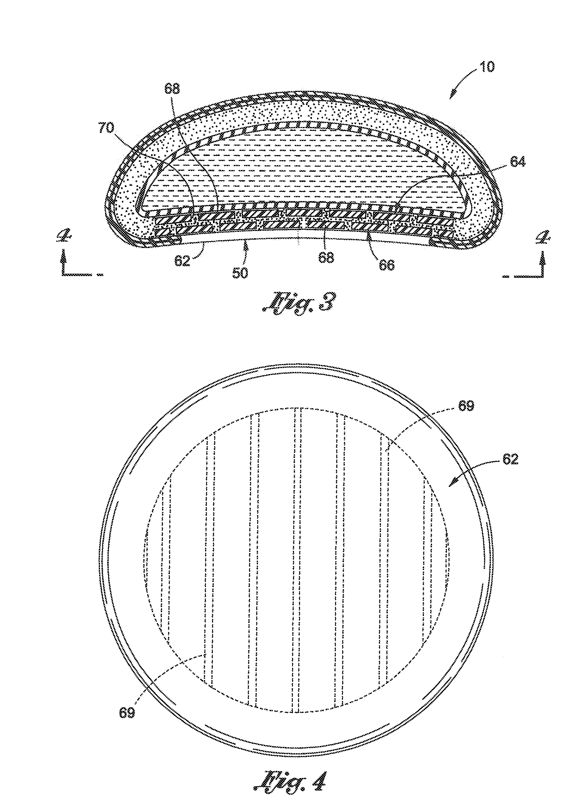 Inflatable prostheses and methods of making same