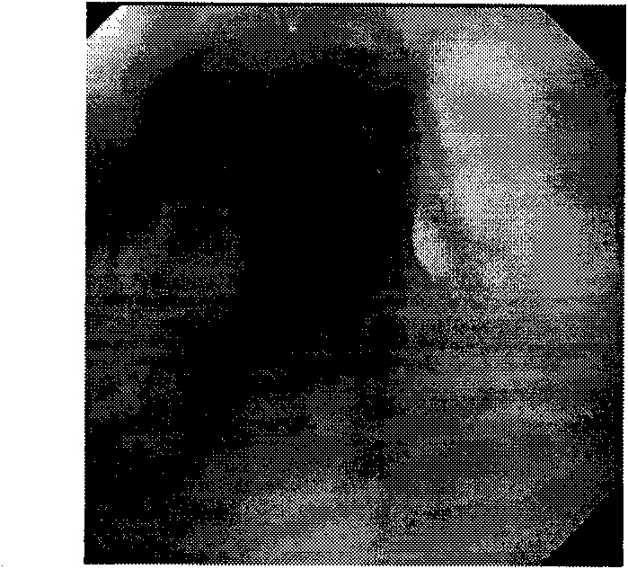 Chinese patent medicament for treating reflux esophagitis and preparation method thereof