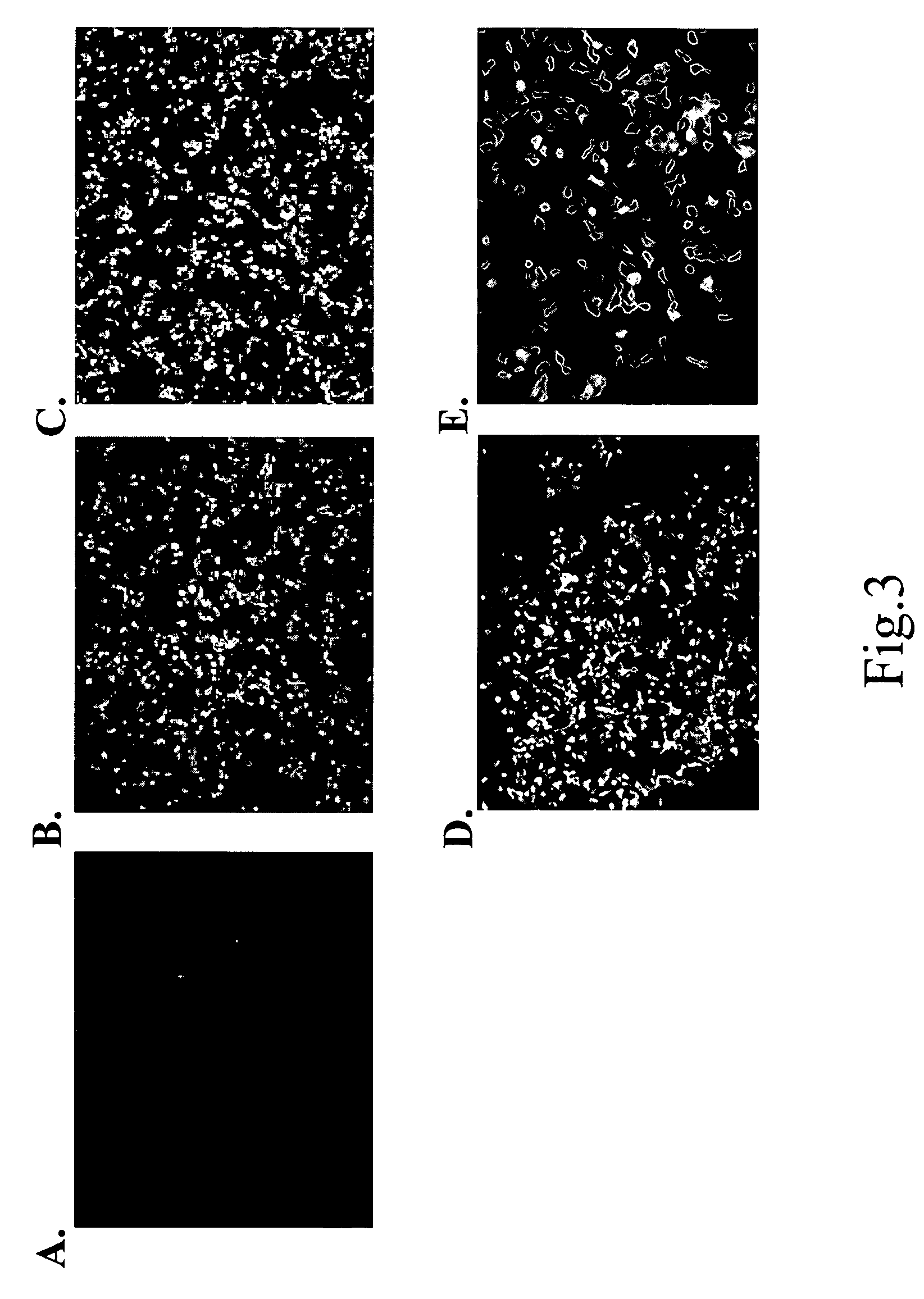 Human soluble neuropilin-1 primary polyadenylation signal and uses thereof