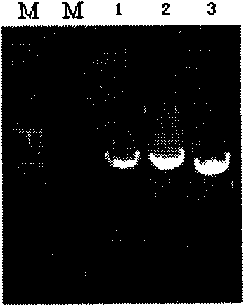 Method for producing periplaneta americana allergen protein Per a 5 in baculovirus-insect expression system