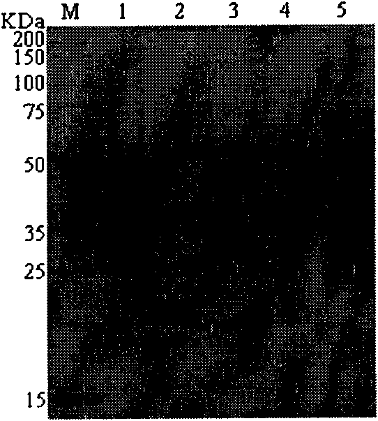 Method for producing periplaneta americana allergen protein Per a 5 in baculovirus-insect expression system