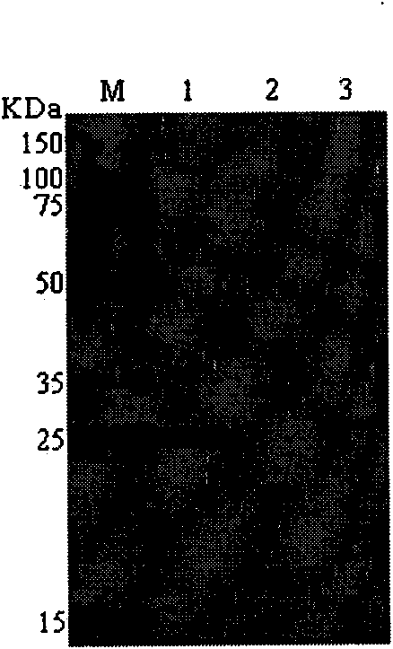 Method for producing periplaneta americana allergen protein Per a 5 in baculovirus-insect expression system