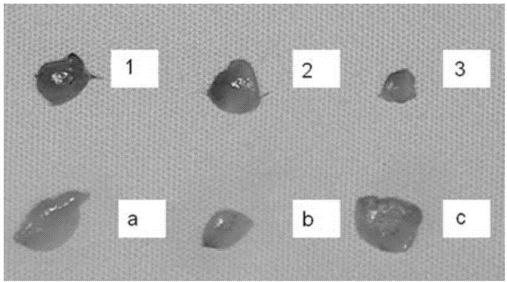 Propranolol hydrochloride submicron emulsion gel and preparation method and application thereof