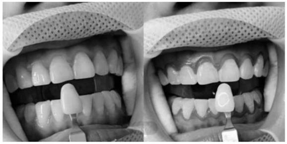 Tooth whitening gel and preparation method thereof