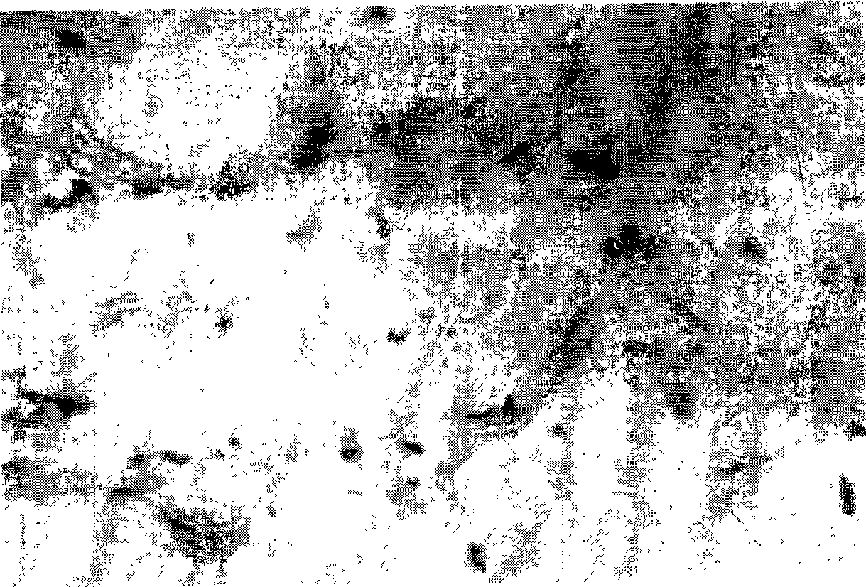 Method for preparing irradiation crosslinking heterogeneous skin acellular matrix and products produced thereby