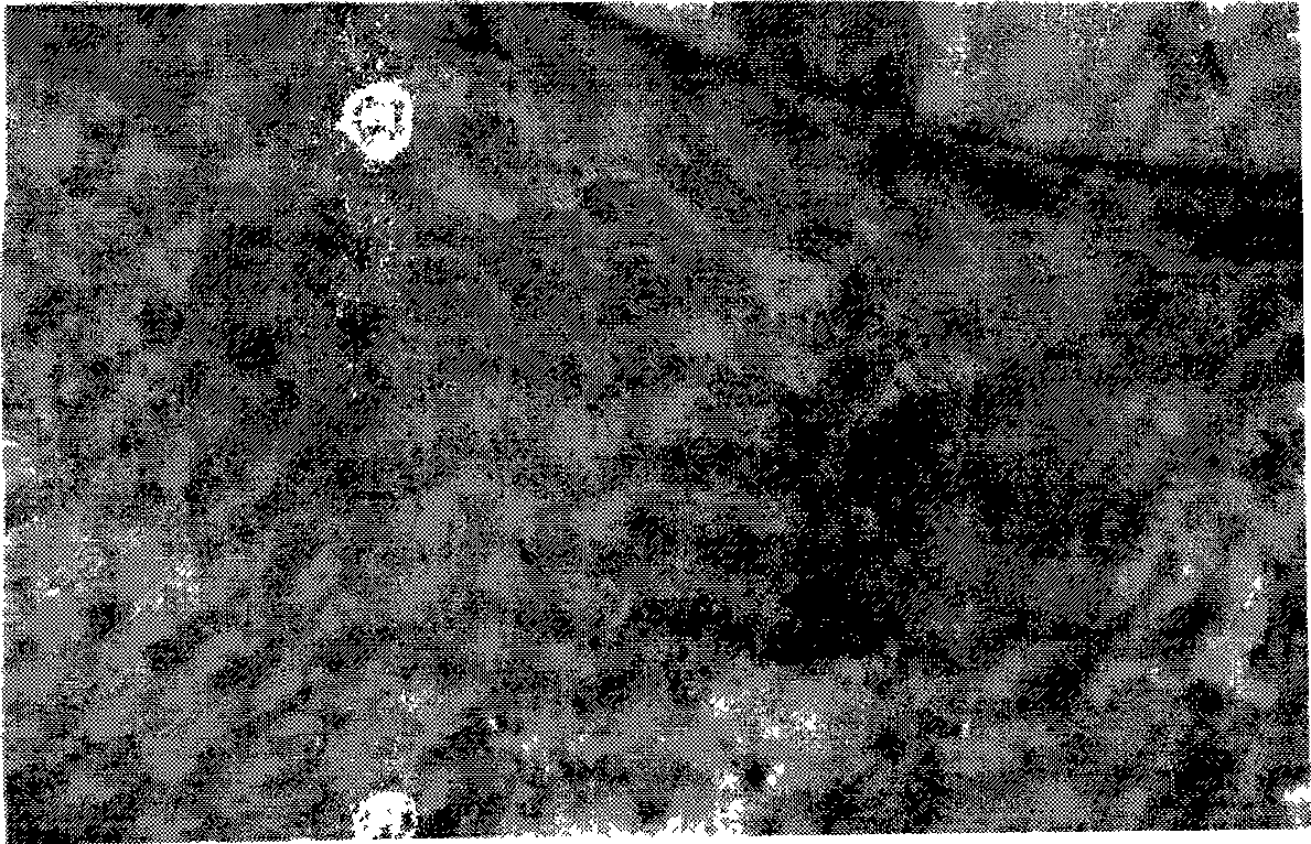 Method for preparing irradiation crosslinking heterogeneous skin acellular matrix and products produced thereby