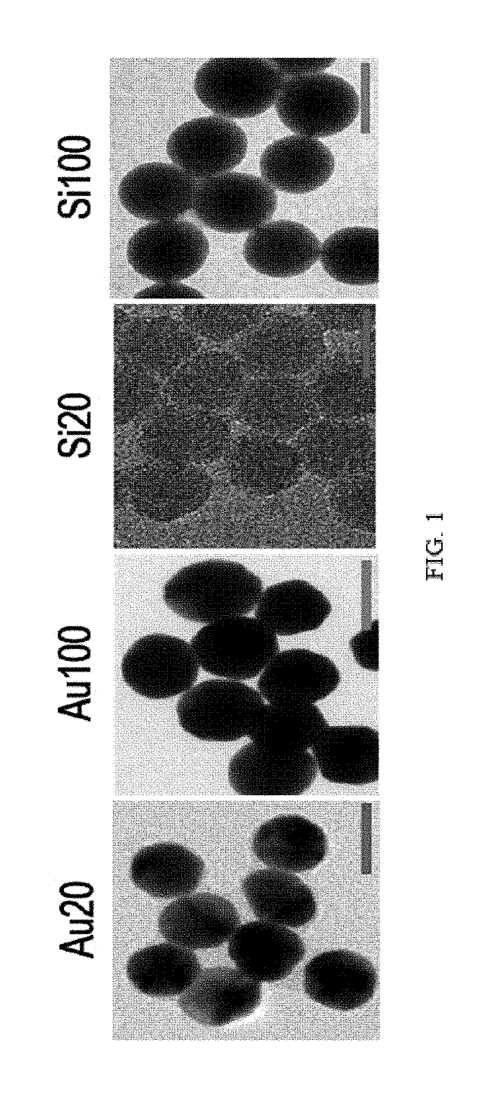 Composition for inhibiting angiogenesis comprising nanoparticle-vitreous body-based protein complex as active ingredient, and use thereof