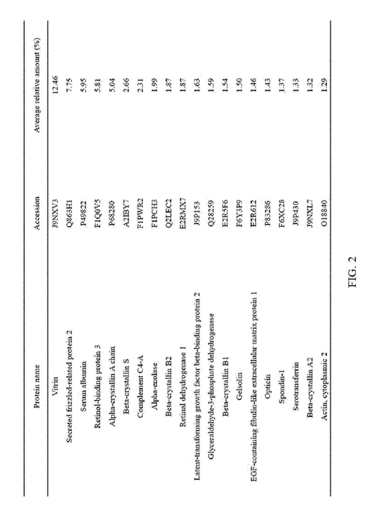 Composition for inhibiting angiogenesis comprising nanoparticle-vitreous body-based protein complex as active ingredient, and use thereof