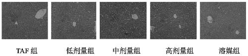 Preparation method and application of Thais clavigera Kuster polysaccharide