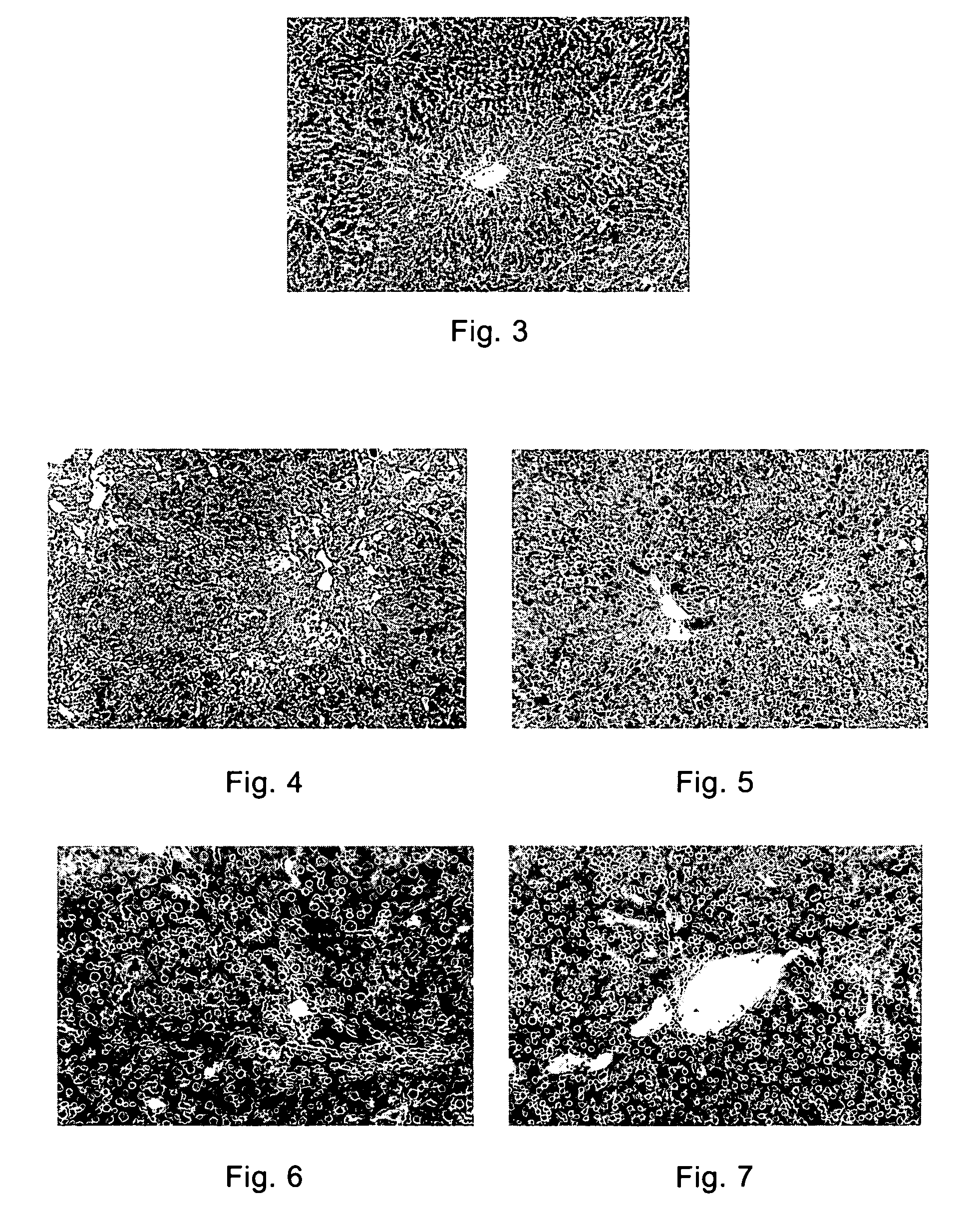 Derivatives of pyridone and the use of them