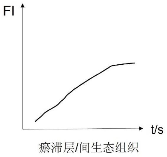 Burn wound tissue activity evaluation system based on fluorescence development image