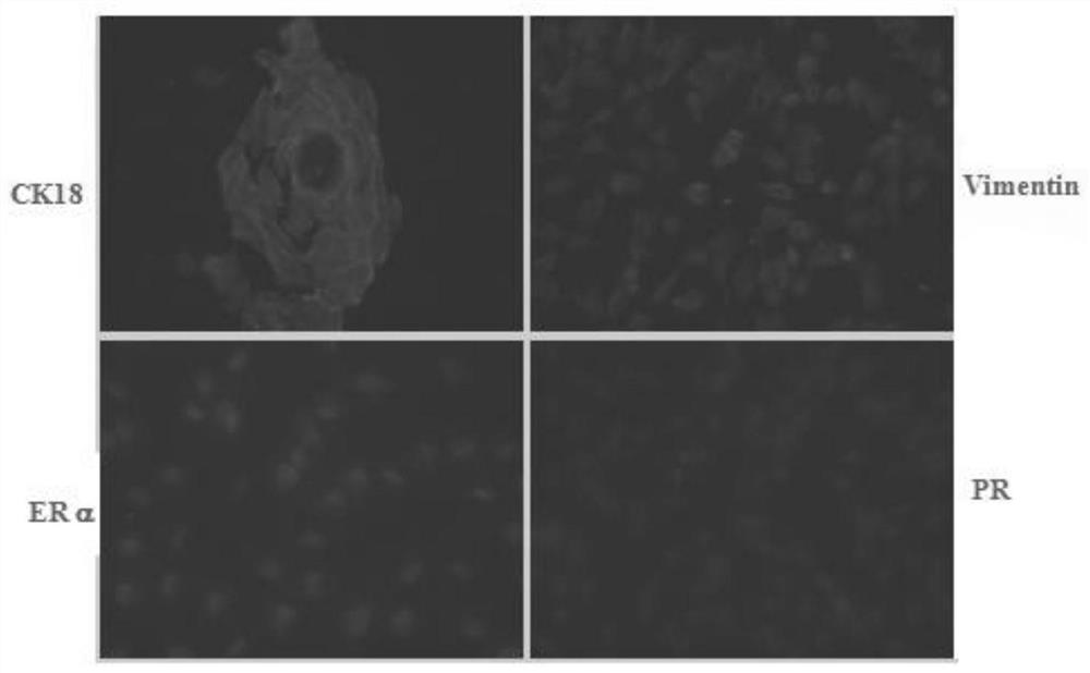 A method and application of constructing adipose stem cell membrane