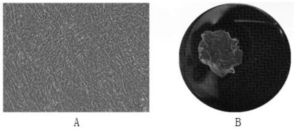 A method and application of constructing adipose stem cell membrane