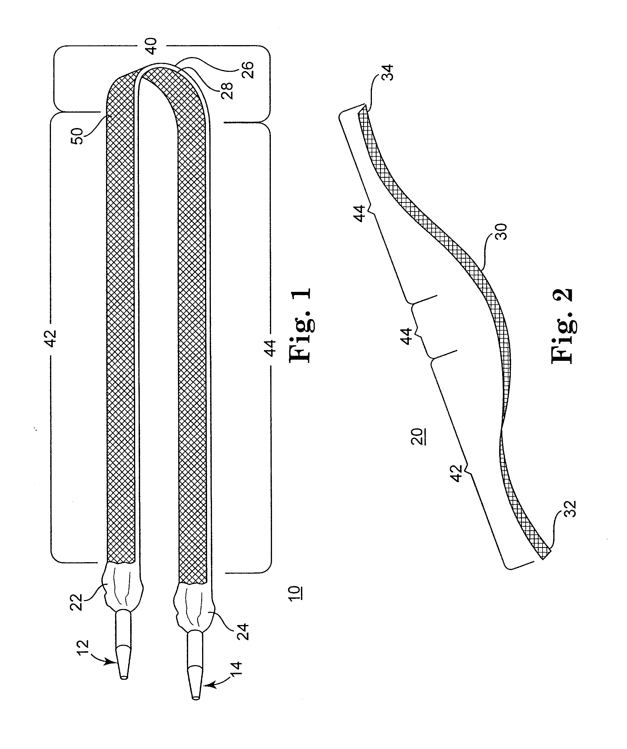 Adjustable Sling and Method of Treating Pelvic Conditions